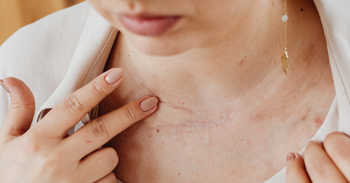 découvrez le concept de couverture santé universelle, un principe essentiel garantissant l'accès aux soins de santé pour tous, sans risque de difficulté financière. apprenez comment ce système favorise l'équité, améliore la santé publique et contribue au bien-être des populations.
